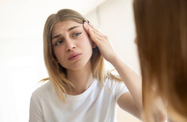 Beauty in the Blemishes post by Tana Lander Writer